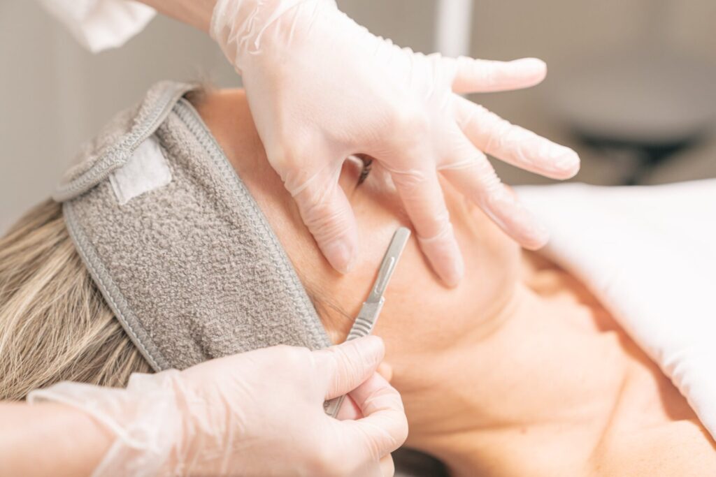 Close-up of a woman receiving a dermaplaning facial treatment with a scalpel-like tool for exfoliation.