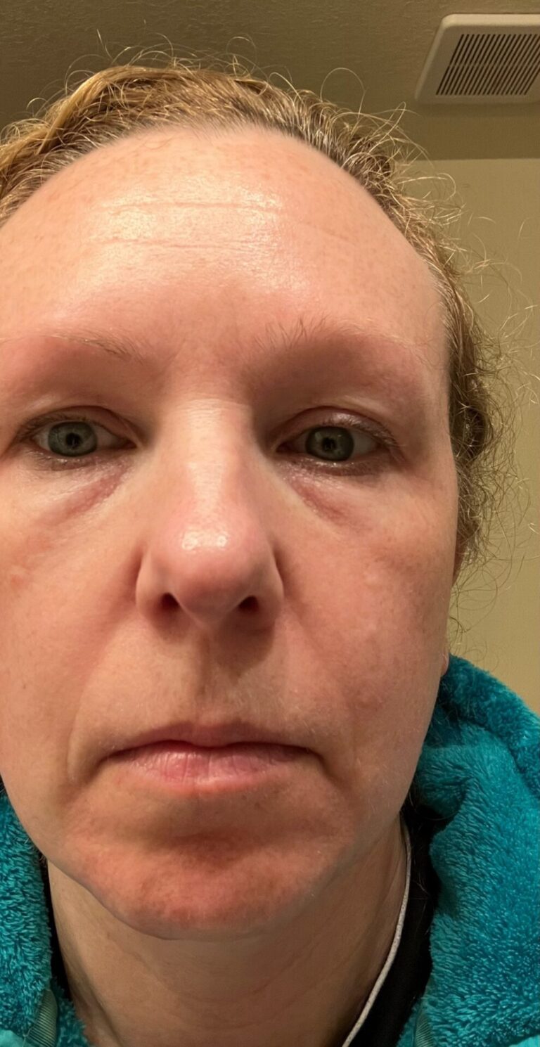 Close-up of a fair-skinned woman's face showing her eyes, nose, and mouth.