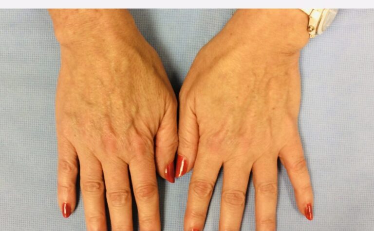 Overhead shot of two hands with red nail polish on a light blue background.